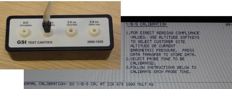 YBG calibration of tymp